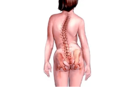 Servikal osteokondroz gelişiminin nedenleri