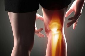 artrozun bir sonucu olarak diz ekleminin tahrip olması