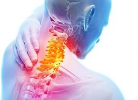 Üçüncü derece osteokondrozlu servikal bölgede ağrı ve ateş