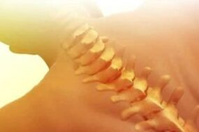 osteokondroz nasıl tedavi edilir